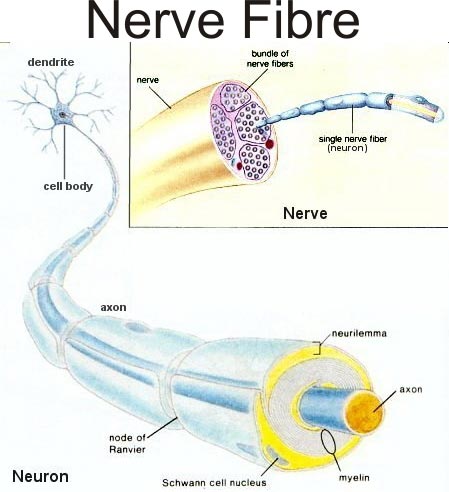 trapped nerve